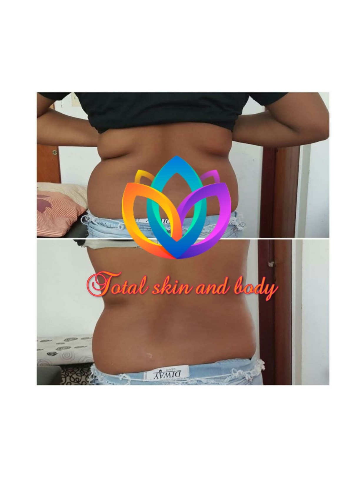 Total skin and body gallery image